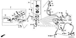 Front Brake Master Cylinder (2)
