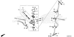 Front Brake Master Cylinder 1