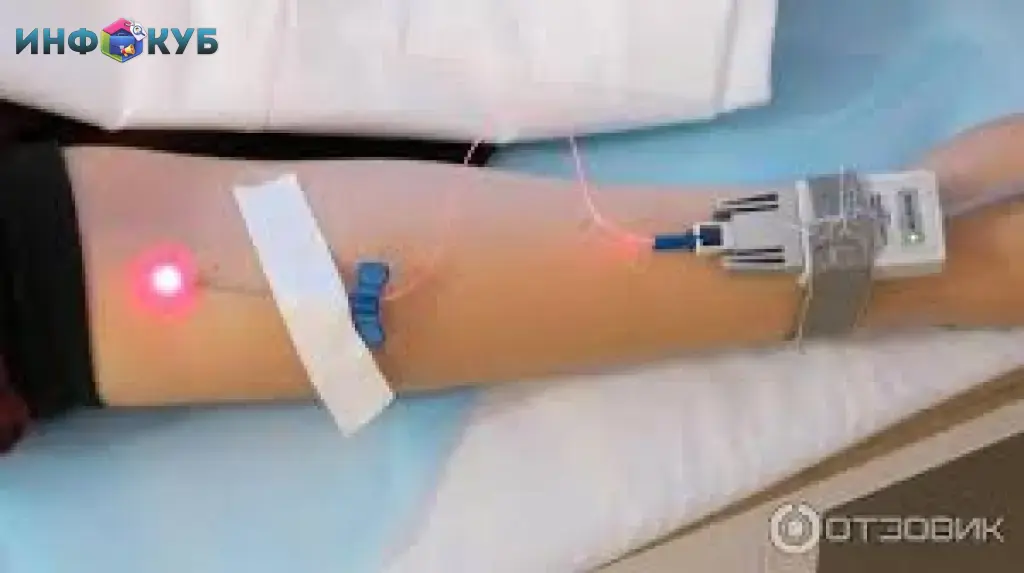 Лазерное и ультрафиолетовое облучение крови.