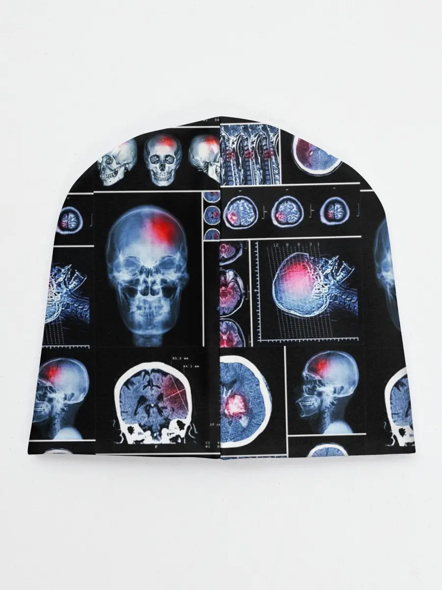 Детская шапка / неврология