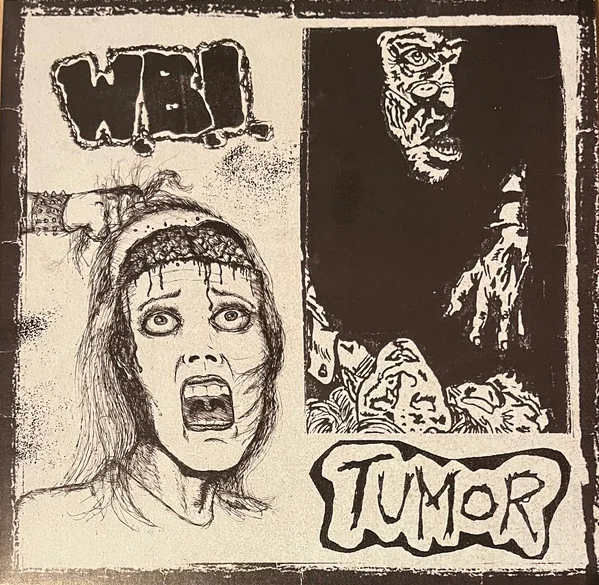 W.B.I. / Tumor