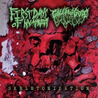 Skeletonization