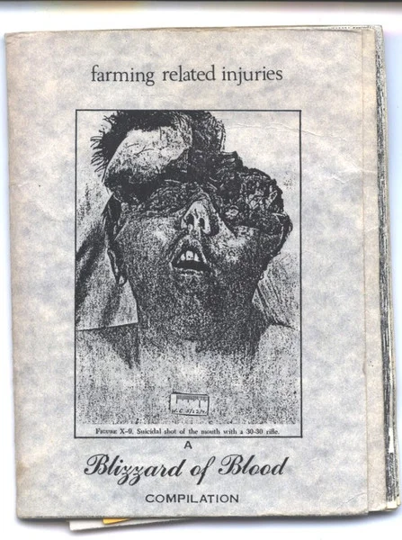 Farming Related Injuries