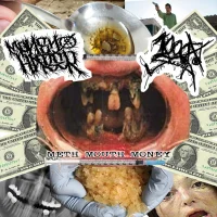 Meth Mouth Money