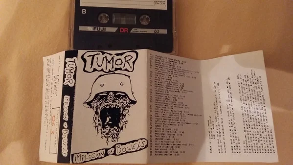 Implosion Of Bowels