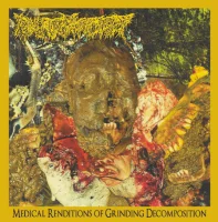 Medical Renditions Of Grinding Decomposition