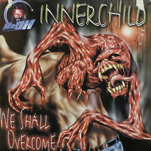 We Shall Overcome