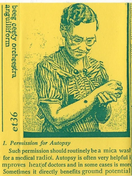 Anguilliform