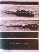 Skin Graft & Scant