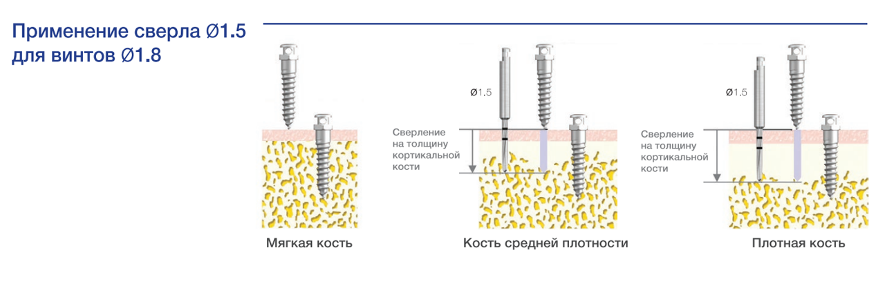 ortosv_15