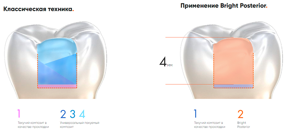 Применение Bright Posterior