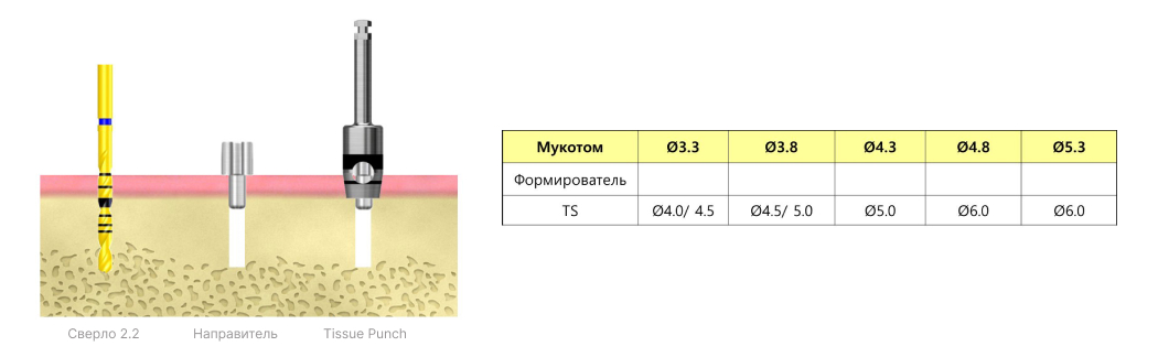 Мукотомы-3
