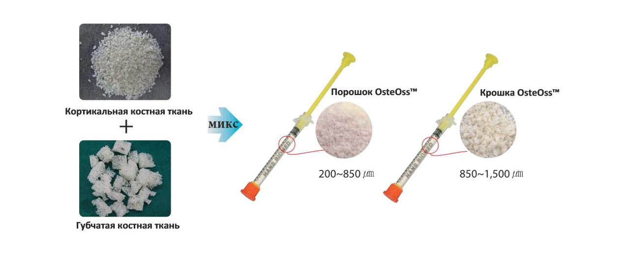 состав крошка кортикально-губчатая OSSTEM OsteOss