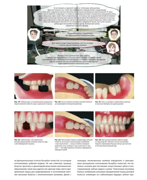 Стандарт полного съёмного зубного протеза. Автор: Накагоми Тасио