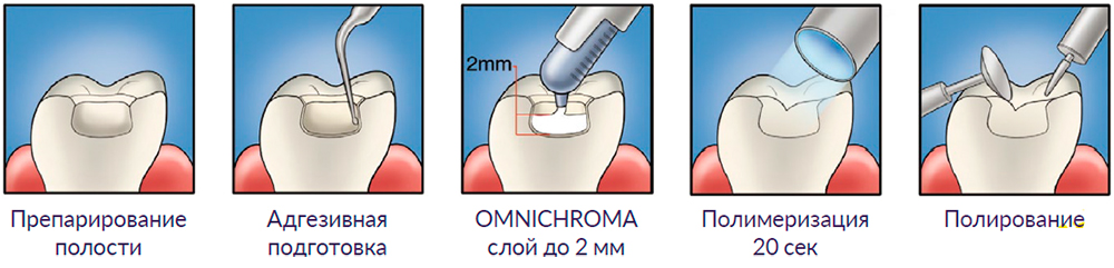 омнихрома