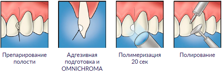 омнихрома