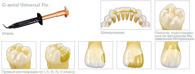 Жидкотекучие композиты G-aenial Universal FLO Жидкотекучие композиты G-aenial Universal FLO