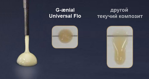 Жидкотекучие композиты G-aenial Universal FLO Жидкотекучие композиты G-aenial Universal FLO