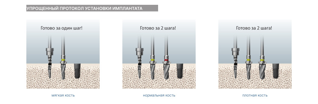 122 Taper Kit (1)