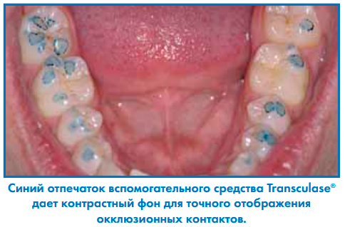 Копирка Бауш