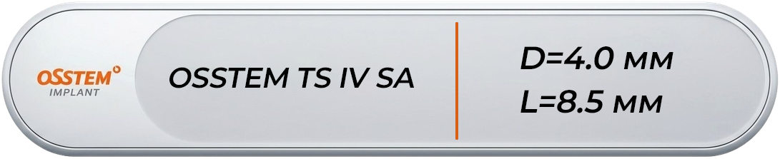 TS4S4008S