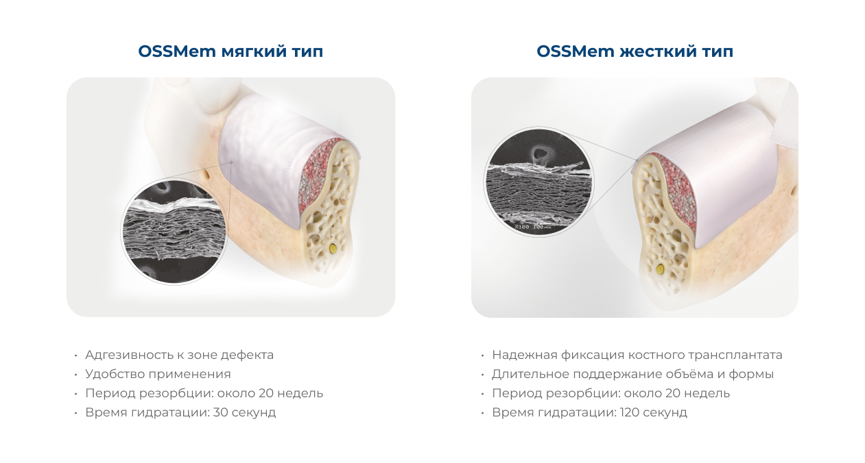 мембрана коллагеновая Osstem OssMem