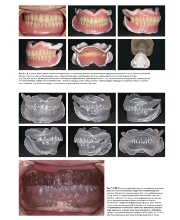 Стандарт полного съёмного зубного протеза. Автор: Накагоми Тасио