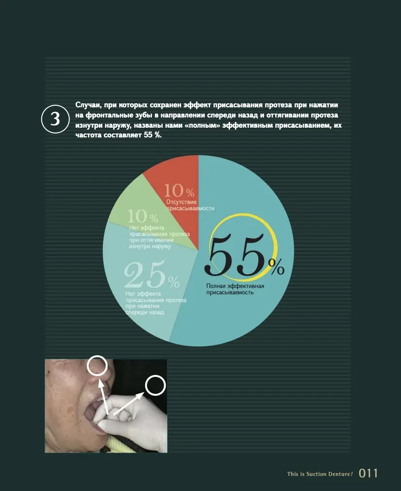 Это присасывающийся протез! Автор: Кацуси Сато
