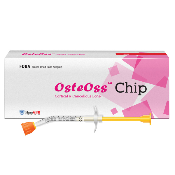 Крошка кортикально-губчатая OSSTEM OsteOss, резорбируемая, для костных дефектов, 1 мл, шприц, 1 шт