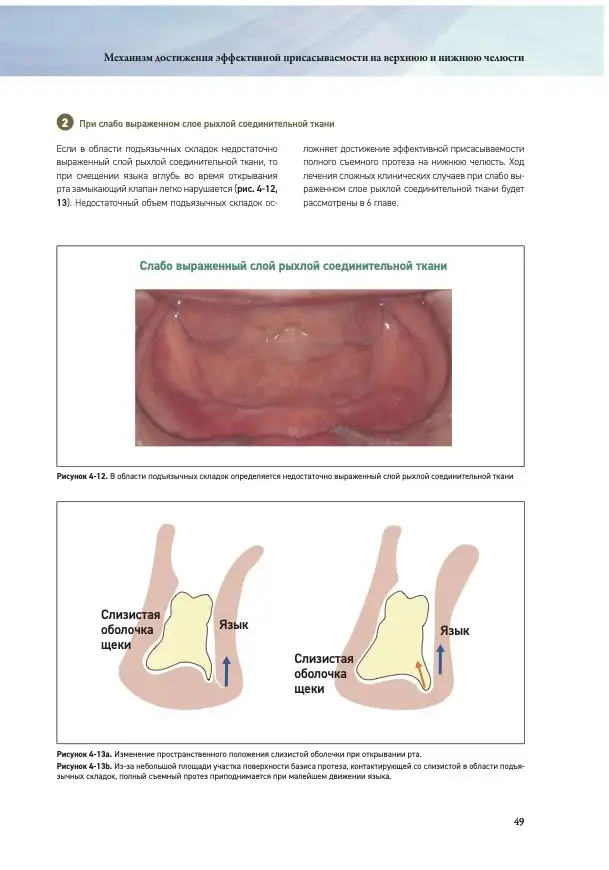 Полный съемный протез на нижнюю челюсть с эффектом присасываемости. Автор: Дзиро Абэ