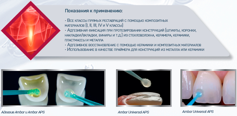 БОНД AMBAR UNIVERSAL APS 5МЛ (БЕСЦВЕТНЫЙ)