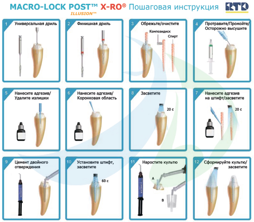 Стекловолоконные Штифты RTD Macro-Lock Post illusion X-RO