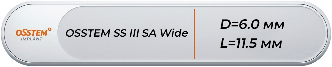 ASS3W6011S20
