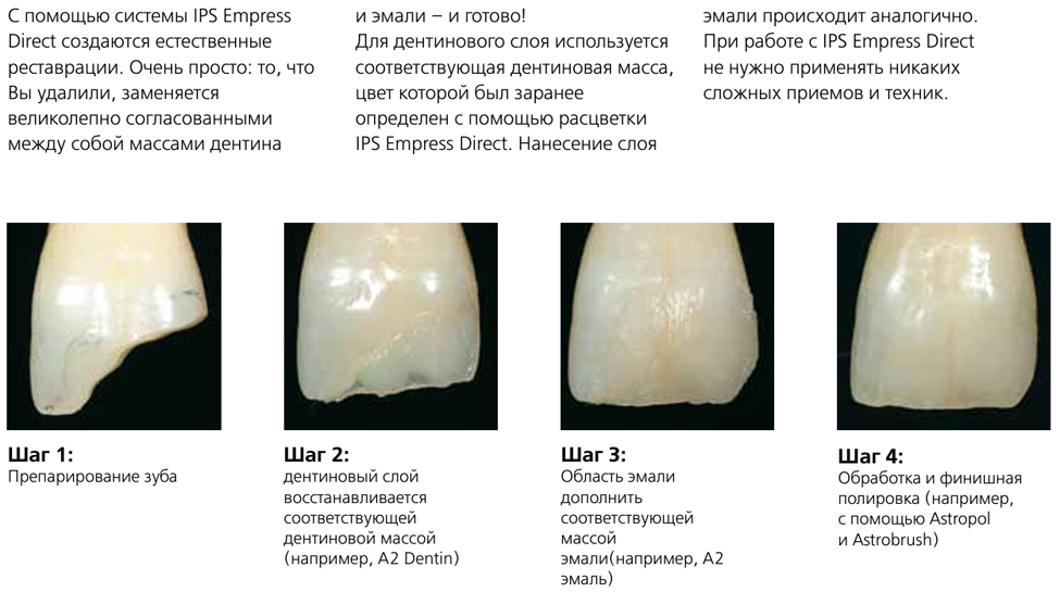 Композит IPS Empress Direct Refill Композит Импресс Дайрект Рефилл
