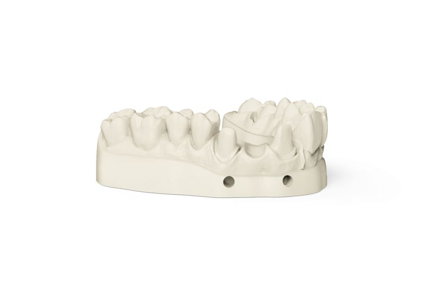 Фотополимер NextDent Model 2.0, оттенок White (белый). Упаковка 1000 гр., арт: NDM2WH01000