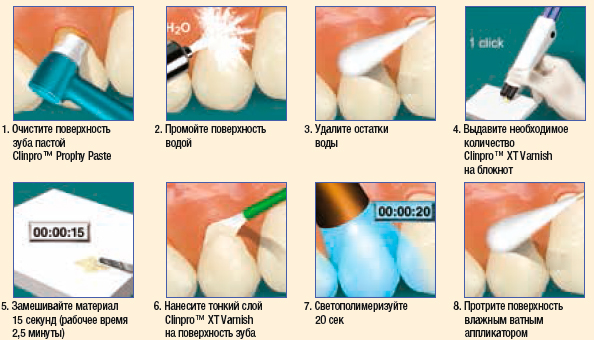 Clinpro XT Varnish – защитное покрытие пролонгированного действи