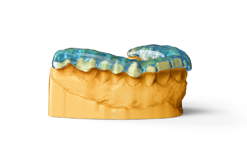 Фотополимер NextDent Ortho Rigid, оттенок Blue (голубой). Упаковка 1000 гр., арт: NDORBL01000