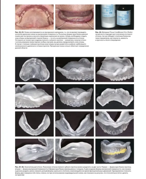 Стандарт полного съёмного зубного протеза. Автор: Накагоми Тасио