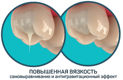 Световые композиты (шприцы, наборы) Opus Bulk Fill Flow APS / Опус балк Филл АПС