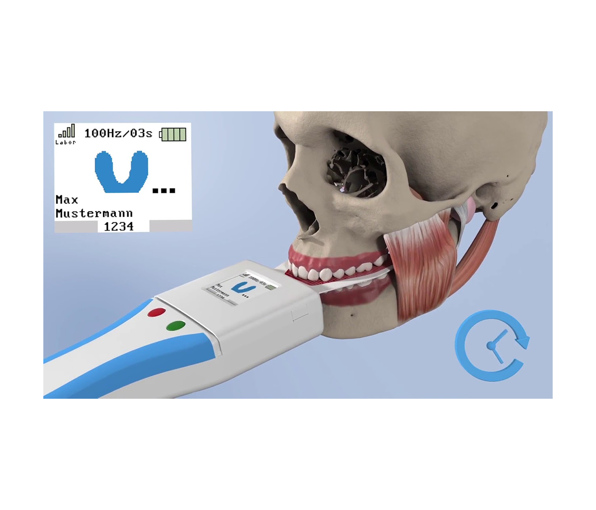 Bausch OccluSense - система для диагностики окклюзии