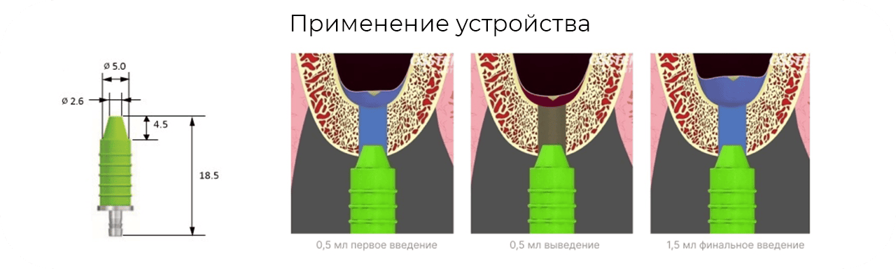 ustroistvo