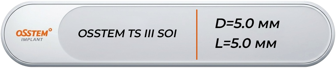 BTS3S5005A