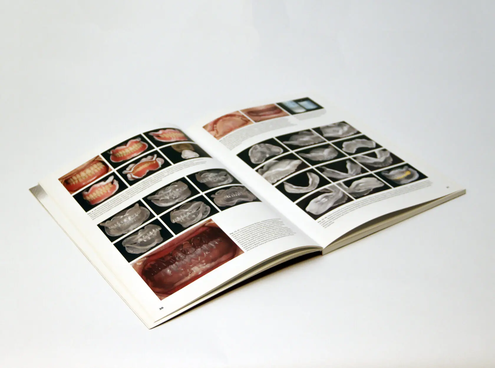 Стандарт полного съёмного зубного протеза. Автор: Накагоми Тасио