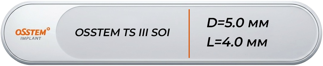 TS3S5004A