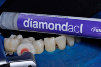 Паста полировочная FGM Diamond ACI & ACII