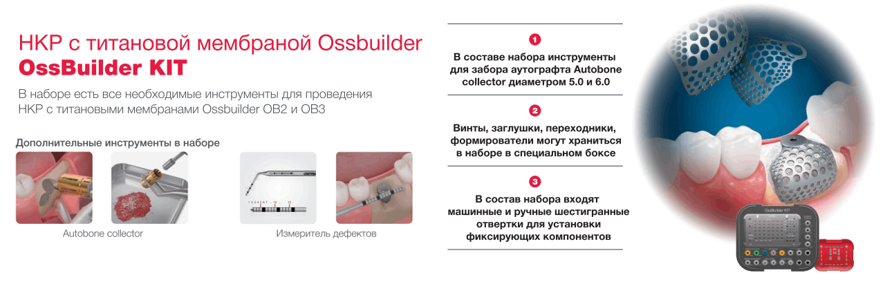 ossBuilder