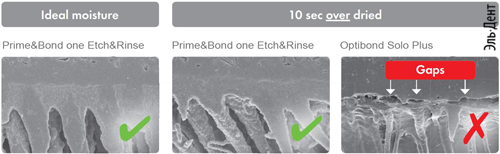 адгезив Прайм Бонд Адгезивы Бондинги PRIME BOND one ETCH RINSE