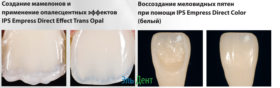 Композит Импресс Дайрект Рефилл