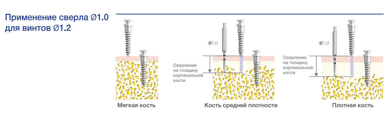 ortosv_1