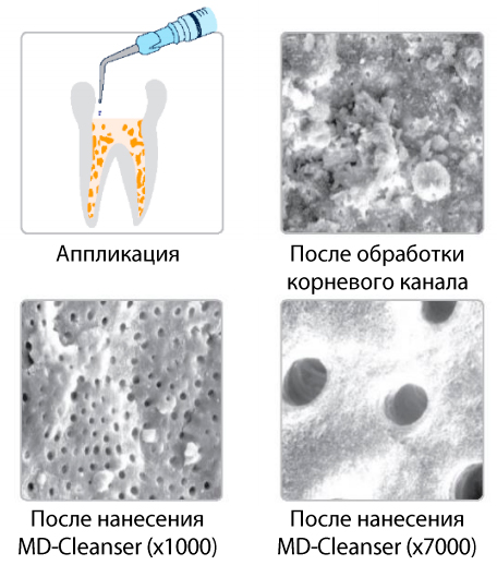 МД-Клинзер